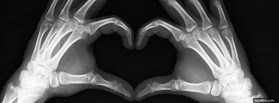 X-Ray Love facebook cover X-Ray Love facebook cover